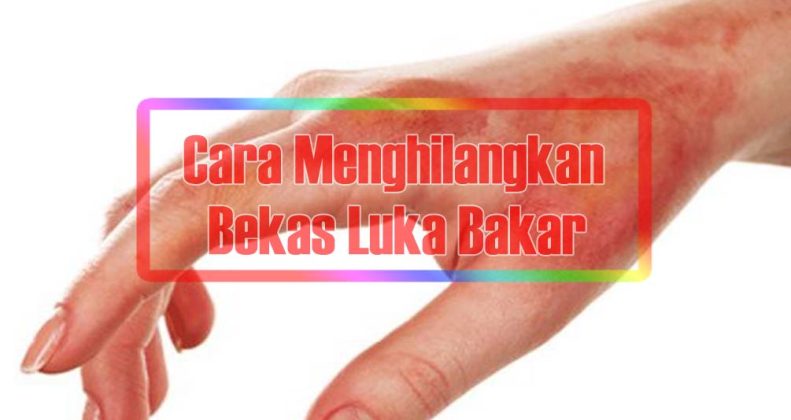 10caramenghilangkanbekaslukabakaryangsudahlama - SEON Digital Marketing